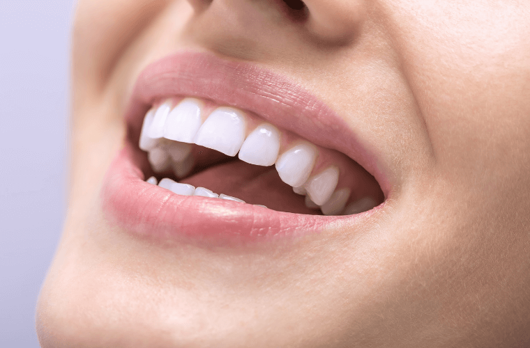 Gula tänder & missfärgade tänder